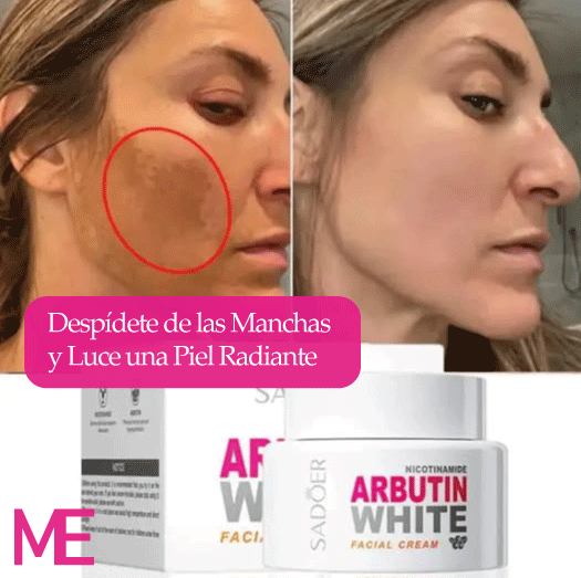 Crema Facial Aclarante Arbutin Sadoer